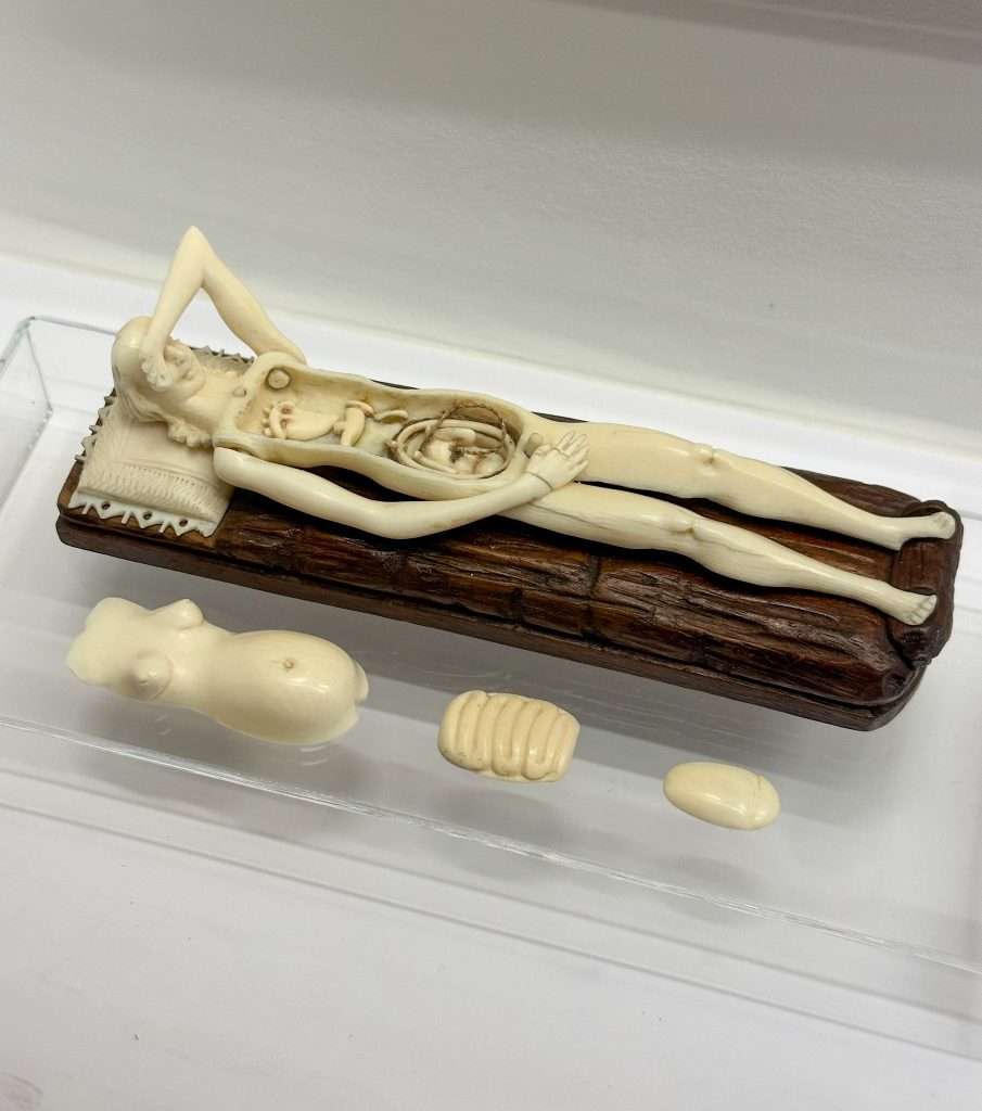 An early anatomy model in the Semmelweis Museum made from ivory possibly and showing a human body as if an autopsy has been performed. 